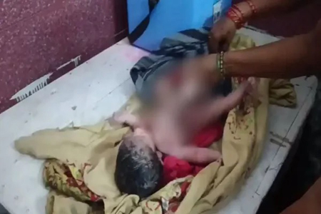 4 हाथ और 4 पैर के साथ जन्मा बच्चा, देखते ही उड़े परिजनों के होश