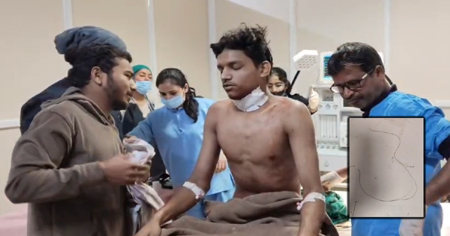 चाइना डोर से युवक का गला कटा: 2 घंटे तक चला ऑपेरशन-12 टांके लगे