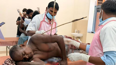 जमीन विवाद में नुकीले तीरों की हुई बौछार, पीड़ित के हाथ में कई तीर धंसे, हालत नाजुक
