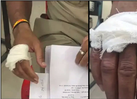 पुलिस टीम पर हमला... शराब पीने से टोकने पर युवकों ने की कॉन्स्टेबल की मारपीट, कटी उंगली, 3 गिरफ्तार